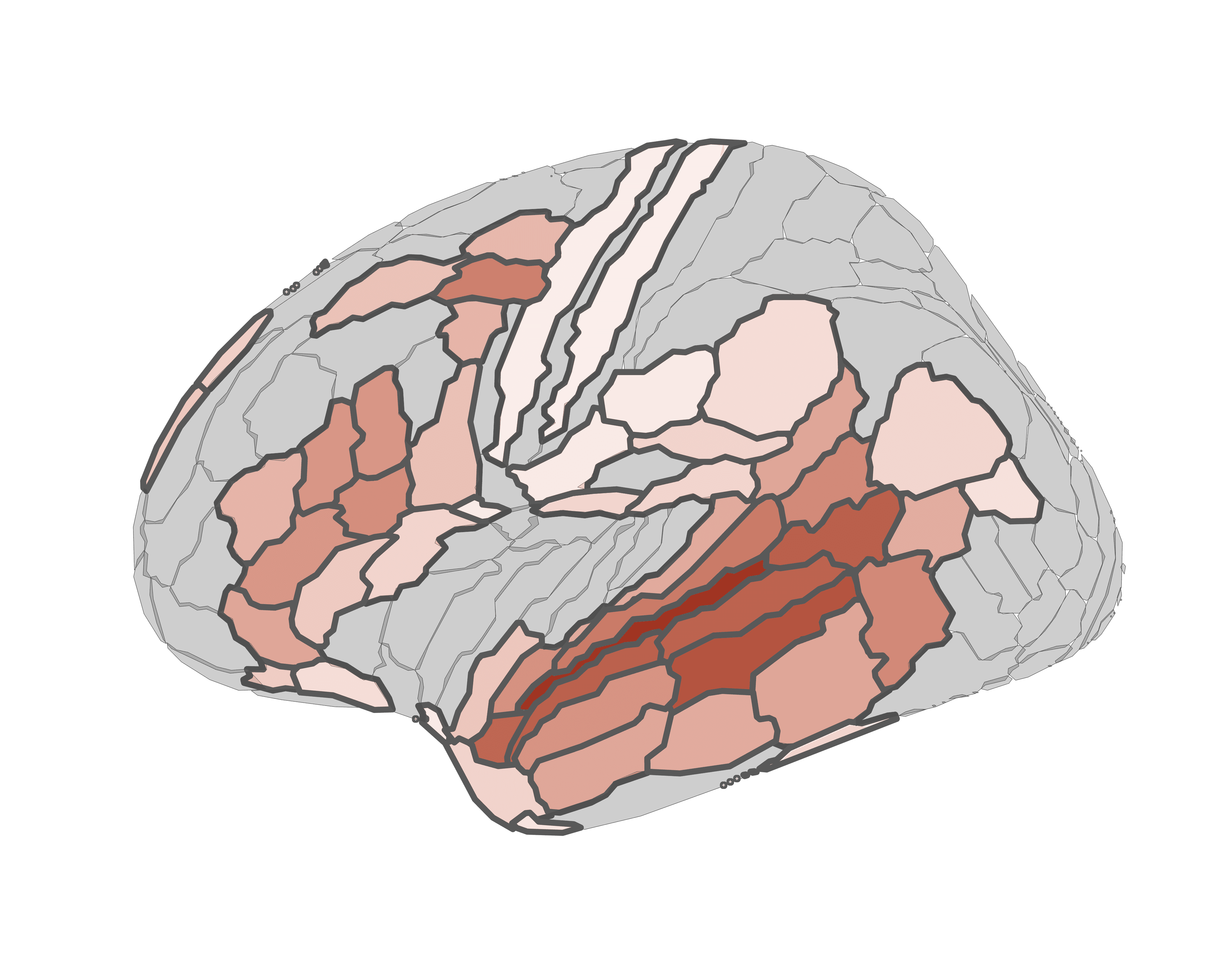 A cortical surface illustration with language-responsive regions shaded in warm tones.
